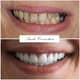 Slider image (7) FMS Dental Hospital - Kukatpally